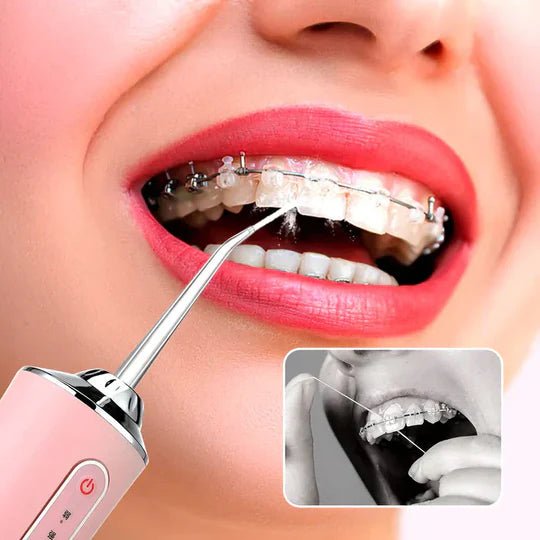 Irrigador Dental Inalámbrico 360